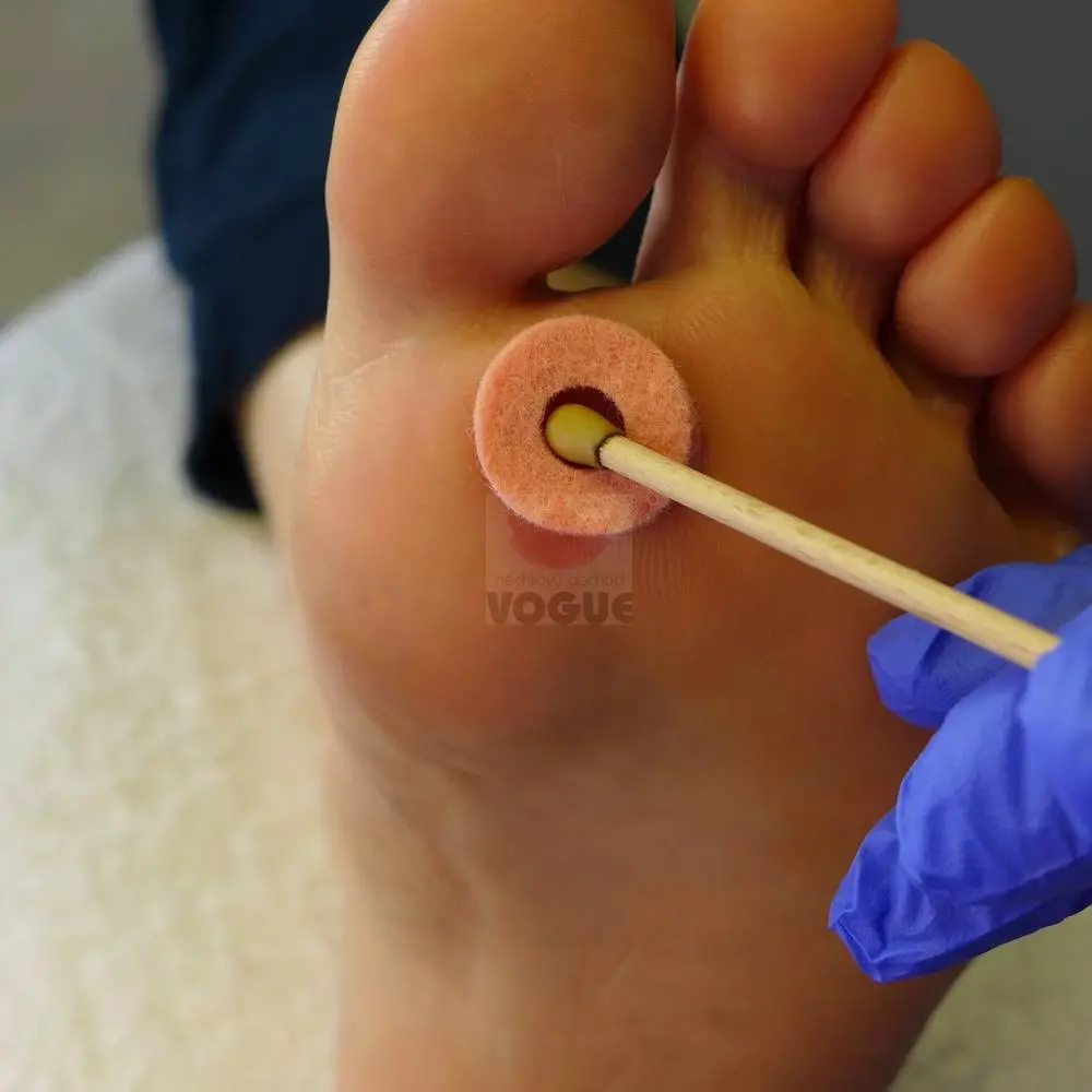 Paličky SILVERIN® STICKS, 50%, 10 ks