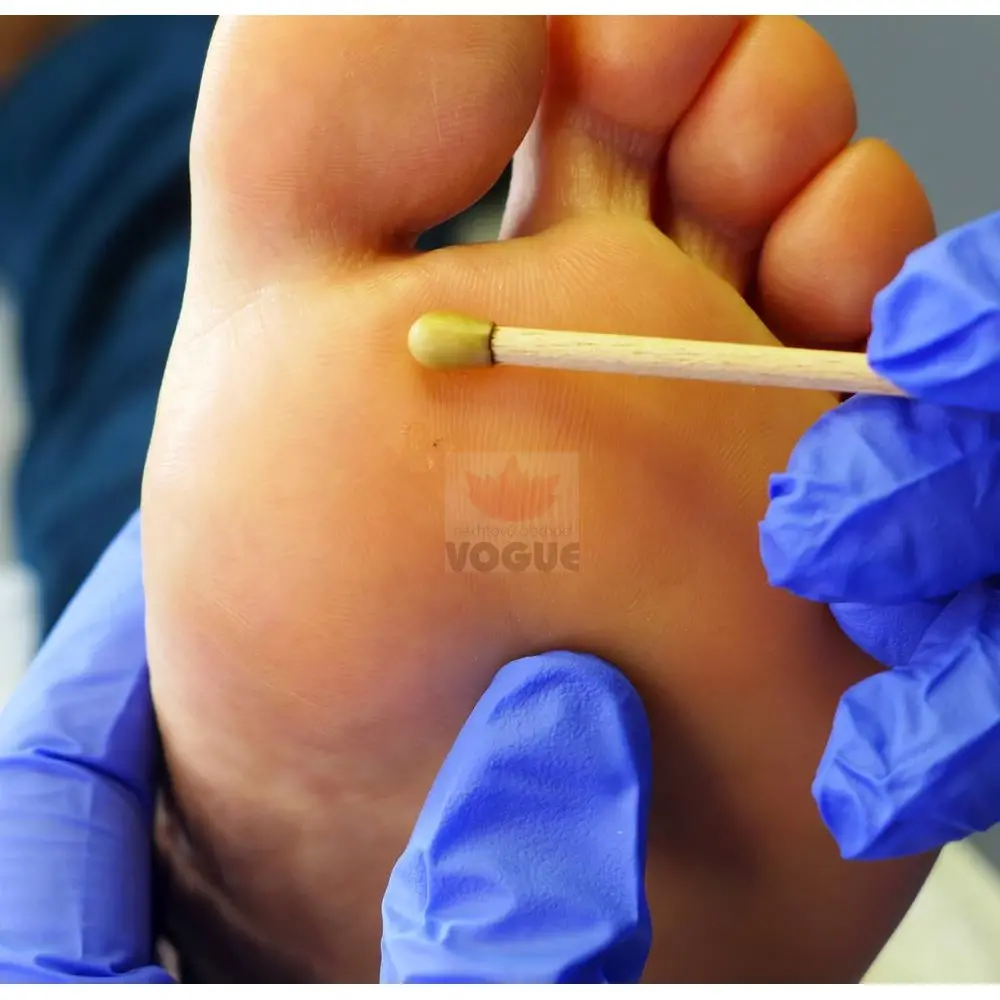 Paličky SILVERIN® STICKS, 50%, 10 ks