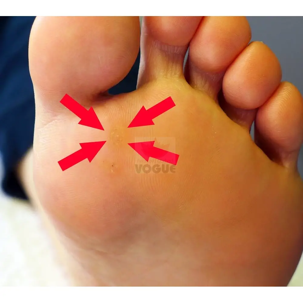 Paličky SILVERIN® STICKS, 50%, 10 ks